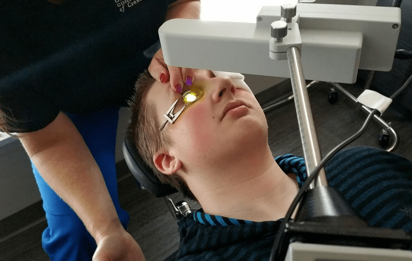 The reticulation effectively eliminates the keratoconus at the beginning of its development